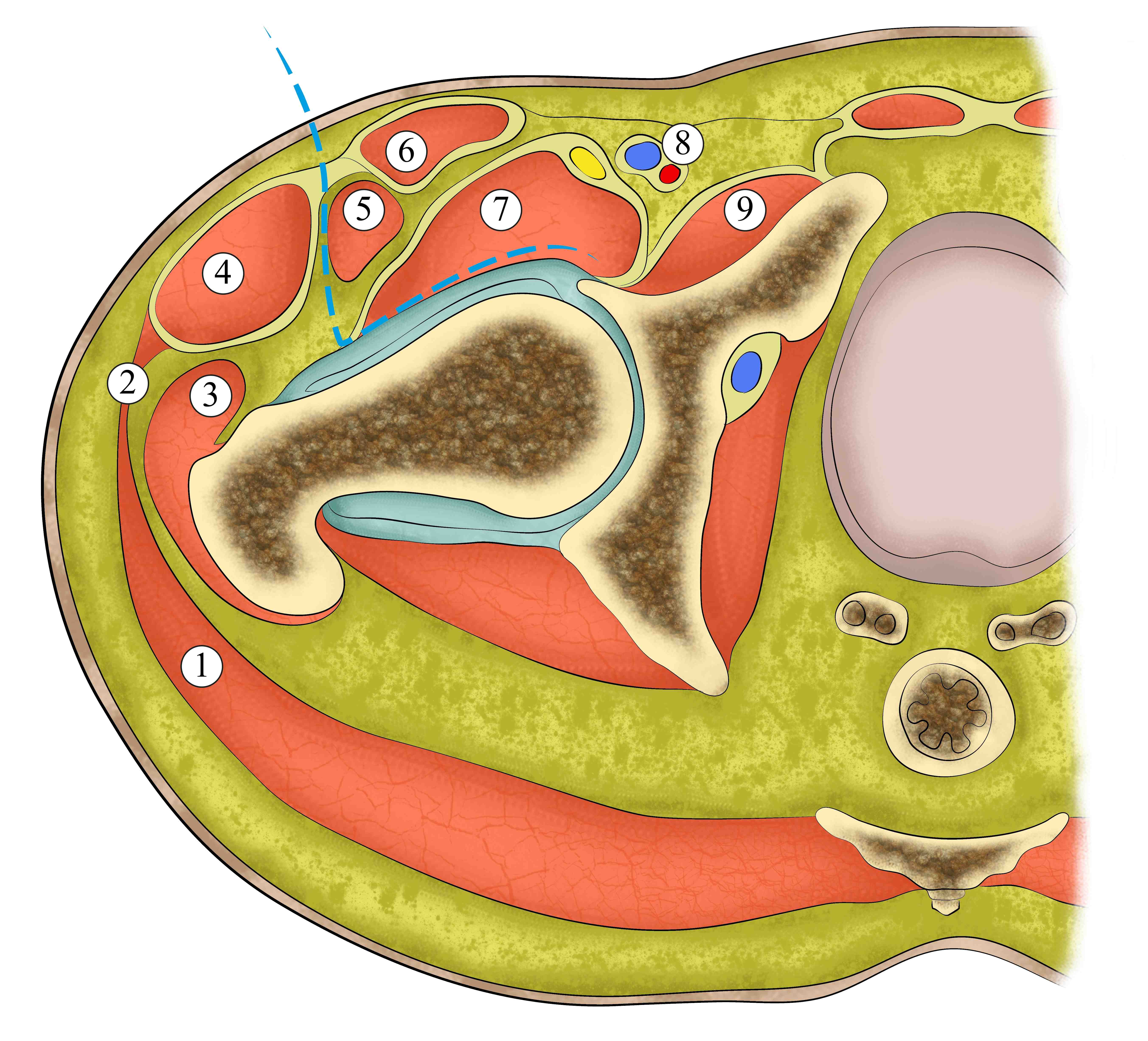 prothese totale de hanche mini abord voie antérieure anatomie hanche Dr Bohu 
